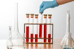 Liquid 5-bromobenzofuran-2-carboxylic Acid Chemical, 97%