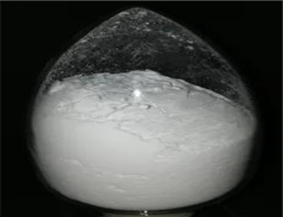 Calcium beta-hydroxy-beta-methylbutyrate