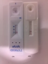 4*5 ml Typhoid IgG/IgM Combo Rapid Test CE