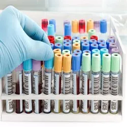 Laboratory Label Sticker, Size: 2x1 Inch